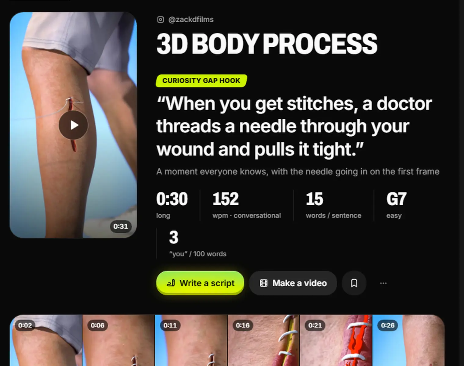 The breakdown of How Stitches Work: the curiosity-gap hook line, then 0:30 long, 152 words per minute, 15 words per sentence, reading grade 7 and 3 'you' per 100 words.