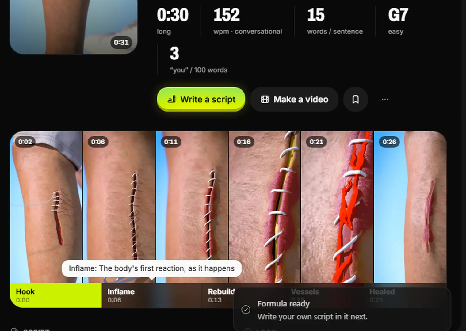 Six screenshots of the video in a filmstrip, with the beats Hook, Inflame, Rebuild, Vessels and Healed and their start times laid over them.
